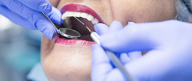 Best Broken or Chipped Tooth Repair in Claremont, NH